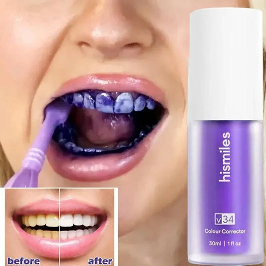 Hismile V34 Teeth Whitening Serum – Color Corrector for a Brighter Smile